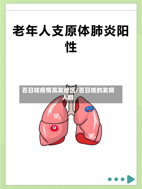 百日咳疫情高发地区/百日咳的发病人群