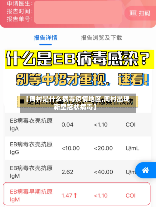 【周村是什么病毒疫情地区,周村出现新型冠状病毒】