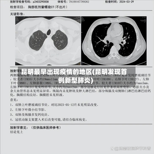 昆明最早出现疫情的地区(昆明发现首例新型肺炎)